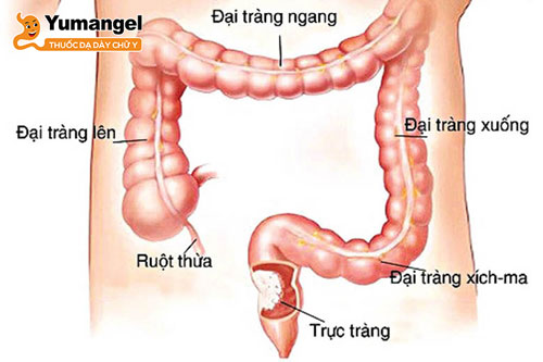 Trực tràng là bộ phận nằm ở cuối ruột già.