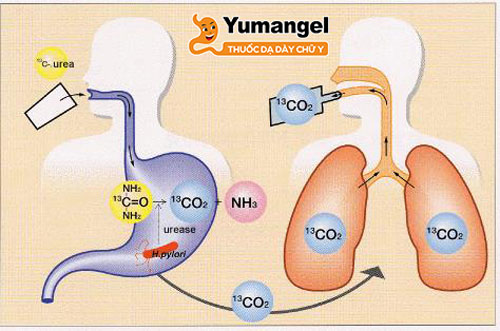 Kiểm tra hơi thở (Urea Breath Test)