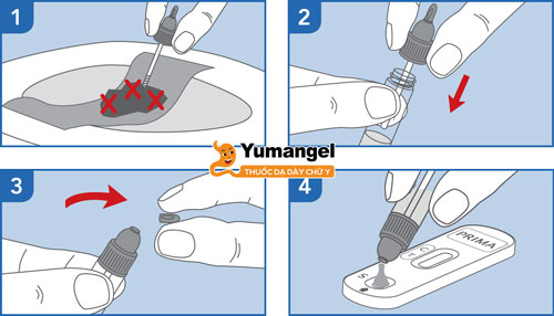 Xét nghiệm phân tìm vi khuẩn HP