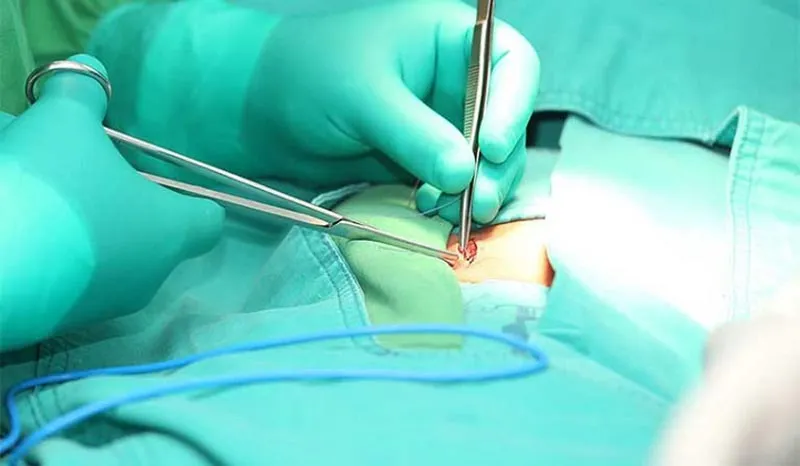 Lưu ý để đảm bảo an toàn và hồi phục tốt sau mổ nội soi dạ dày