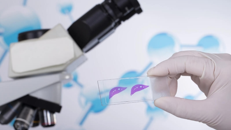 giá nội soi dạ dày bệnh viện e