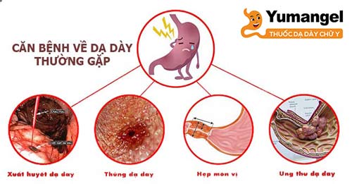 Các bệnh lý dạ dày phổ biến nhất là nhiễm vi khuẩn HP, viêm loét dạ dày, trào ngược dạ dày thực quản… 