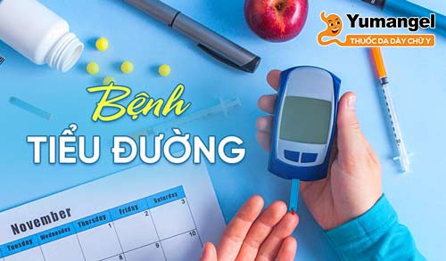 Bệnh tiểu đường là tình trạng xảy ra khi lượng đường trong máu (glucose) quá cao.