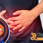 Viêm teo niêm mạc dạ dày C2 phổ biến hơn ở những người thường xuyên uống rượu, hút thuốc lá, lạm dụng thuốc NSAID…