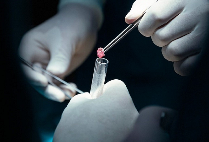 Giá nội soi đại tràng Bệnh viện Bạch Mai