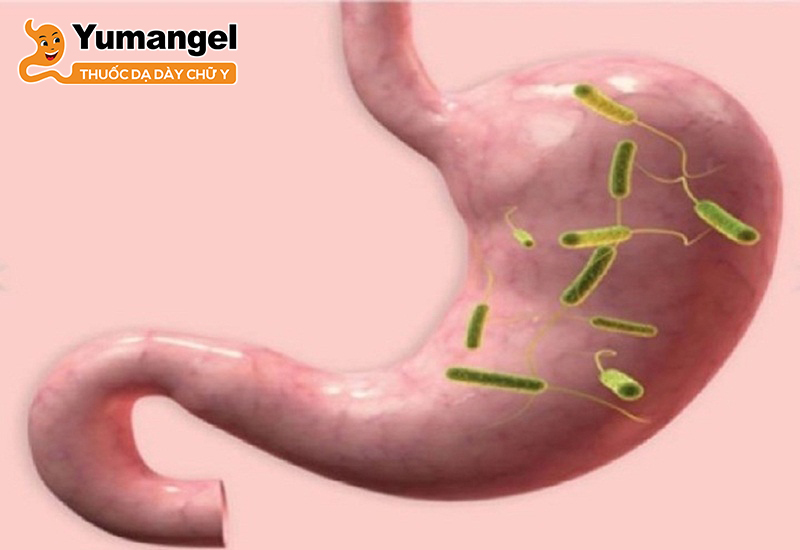 Kết quả xét nghiệm HP dạ dày dương tính có nghĩa là bạn bị nhiễm H.pylori.