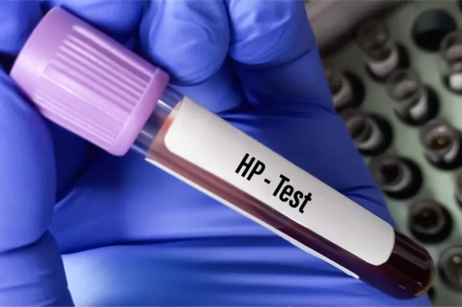 Xét nghiệm kháng thể HP trong máu