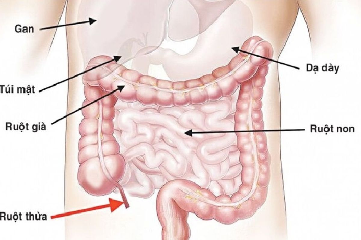 dau-bung-nhu-kim-cham-2
