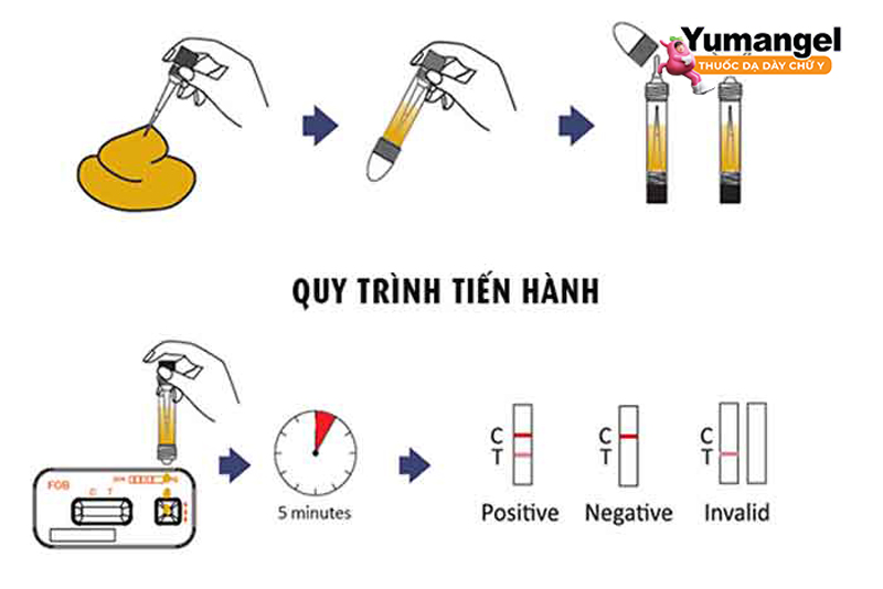 Xét nghiệm kháng nguyên phân giúp chẩn đoán hiệu của phương pháp điều trị HP.  