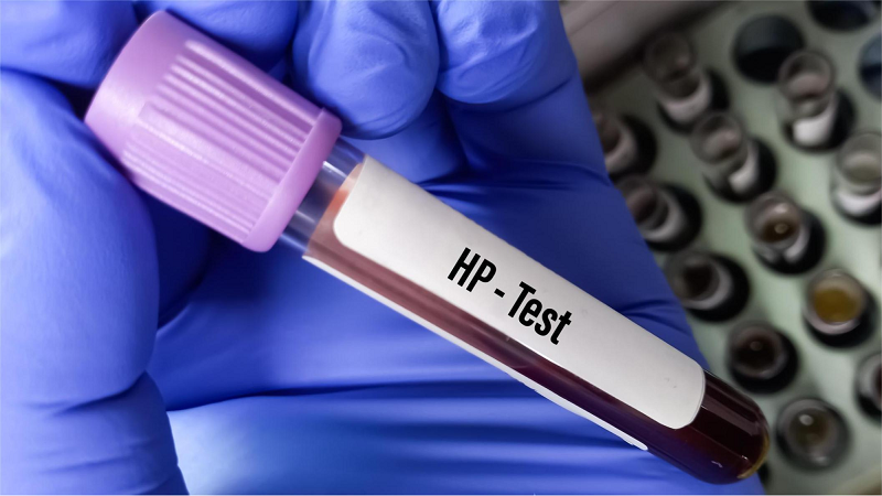 quy trình test hp hơi thở
