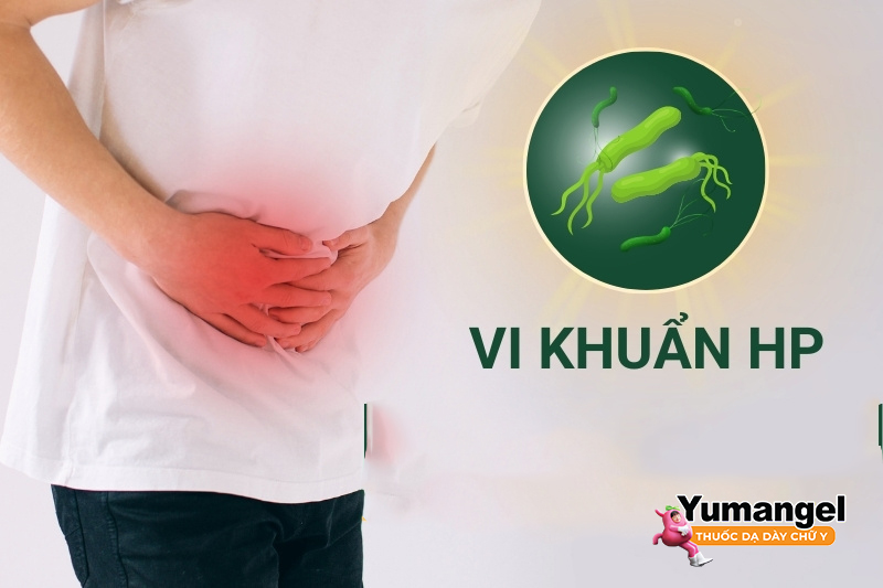 Bất kỳ ai được chẩn đoán mắc H.pylori đều nên tiến hành điều trị để tránh gây biến chứng viêm loét dạ dày tá tràng, ung thư dạ dày. 