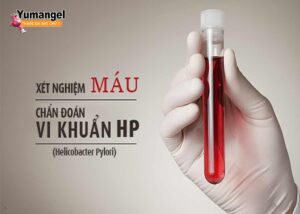 Xét nghiệm HP dạ dày bằng máu