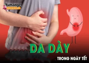 Vấn đề dạ dày thường gặp trong ngày Tết