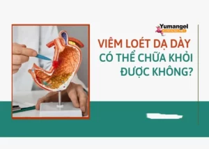 Viêm loét dạ dày có chữa khỏi được không?