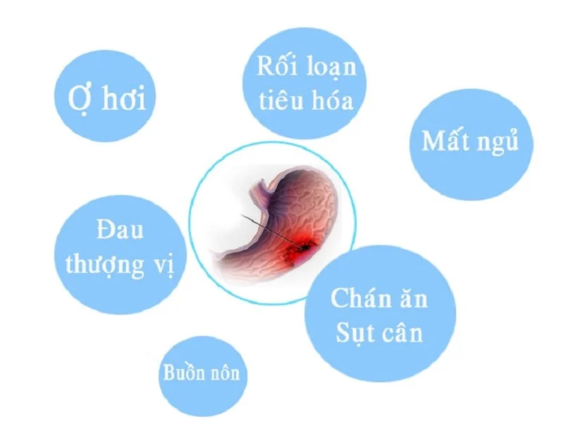 nội soi dạ dày có phát hiện ung thư không 3