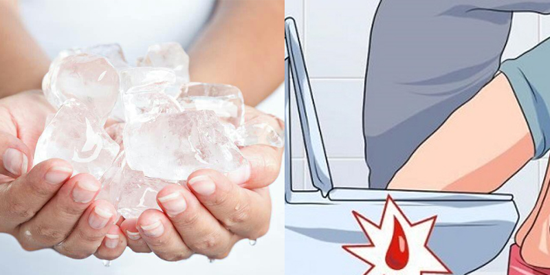 Chườm lạnh vùng hậu môn