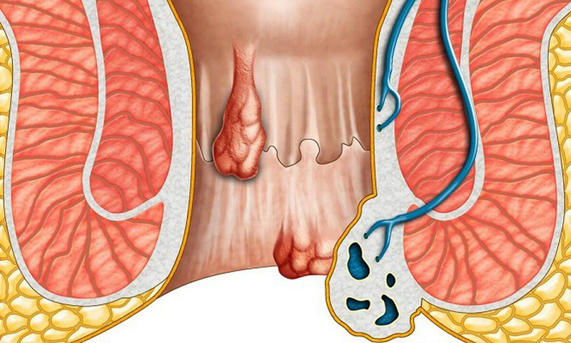 Các triệu chứng phổ biến