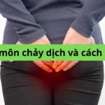 hậu môn chảy dịch