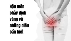 hậu môn chảy dịch vàng