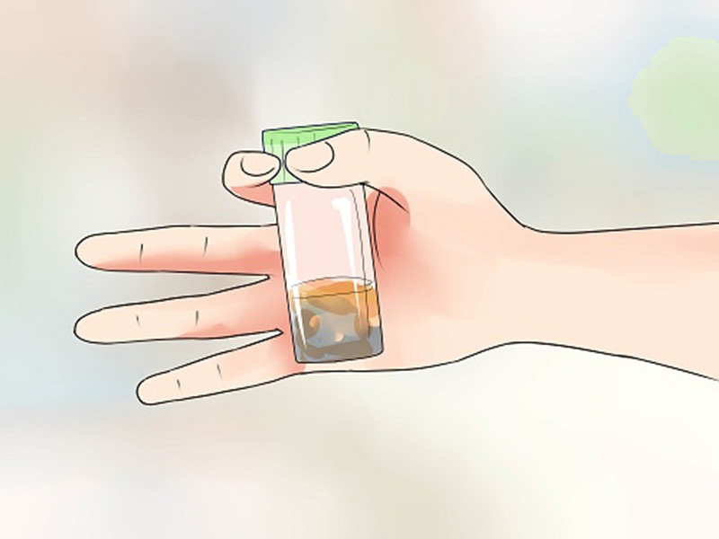 Ngứa hậu môn bị bệnh gì