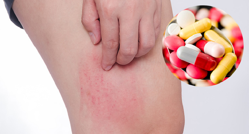 thuốc xổ nội soi đại tràng