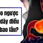 trào ngược dạ dày điều trị bao lâu thì khỏi?