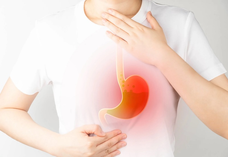 trào ngược dạ dày điều trị bao lâu