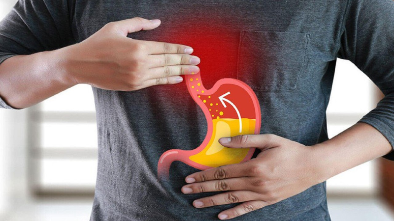 trào ngược dạ dày điều trị bao lâu