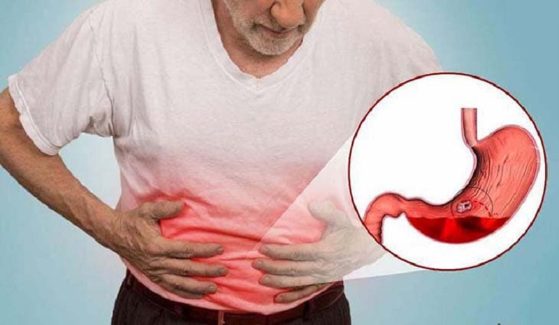 Uống kim tiền thảo có hại dạ dày không