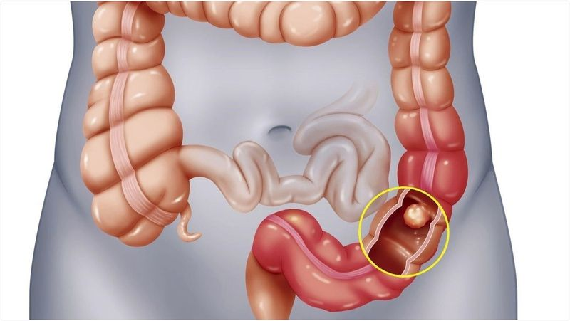 ​uống nước gì tốt cho đại tràng​