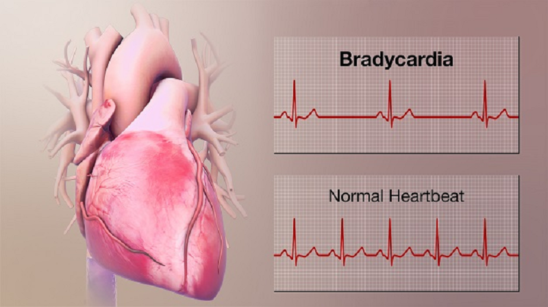 bệnh dạ dày có ảnh hưởng đến tim không