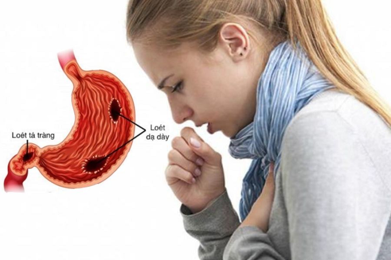 trào ngược dạ dày bao lâu thì bị ung thư