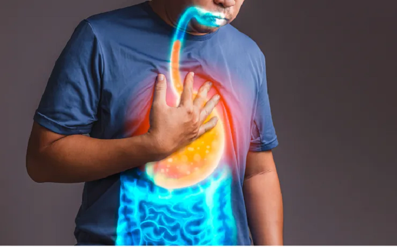 trào ngược dạ dày có phải nội soi không