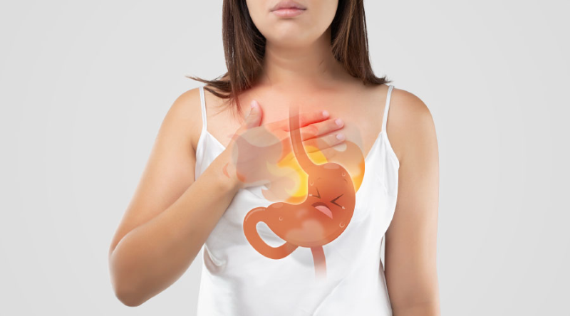 trào ngược dạ dày có phải nội soi không