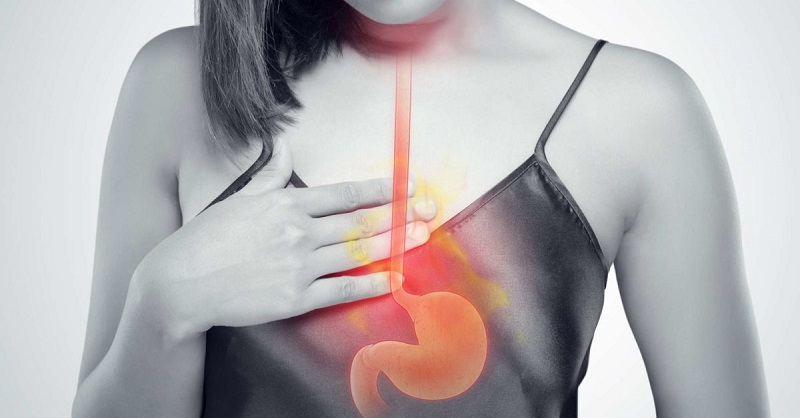 trào ngược dạ dày có phải nội soi không