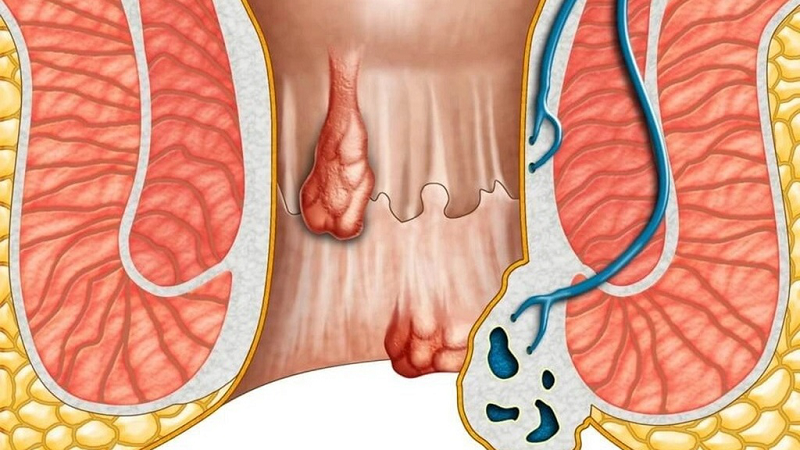 vệ sinh hậu môn đúng cách