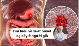 Xuất huyết dạ dày ở người già