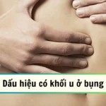 dấu hiệu có khối u ở bụng