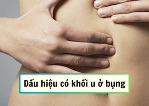 dấu hiệu có khối u ở bụng
