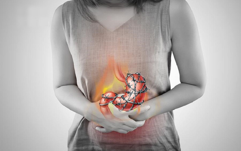 gist dạ dày là gì
