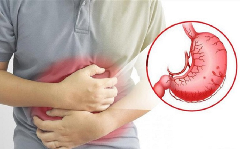 tại sao căng thẳng lại đau dạ dày