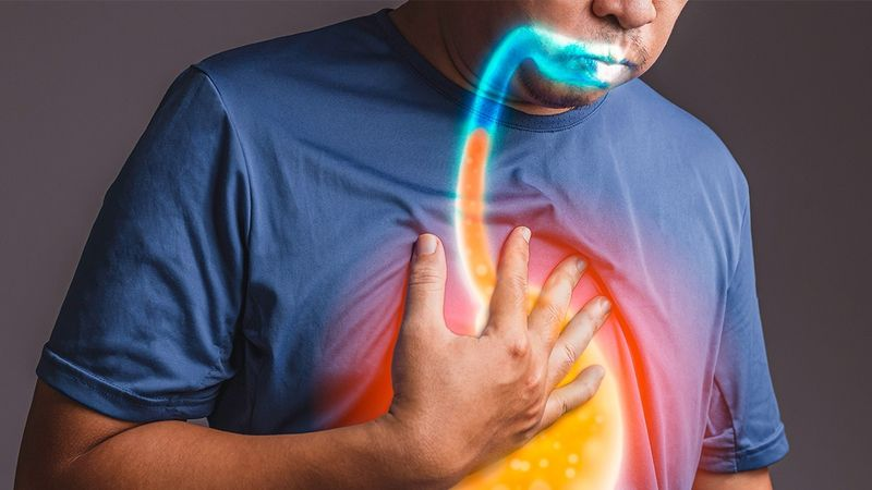 Cơ chế mối liên hệ giữa GERD và hệ thần kinh