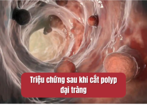 triệu chứng sau khi cắt polyp đại tràng
