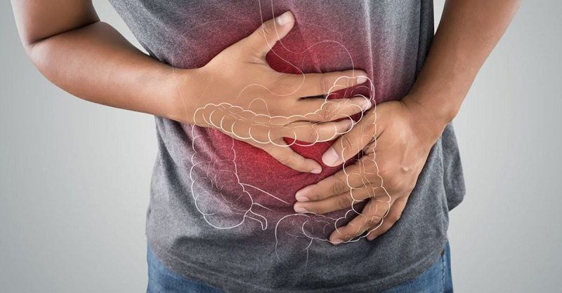 triệu chứng sau khi cắt polyp đại tràng