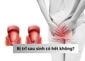 bị trĩ sau sinh có hết không