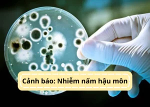 nhiễm nấm hậu môn