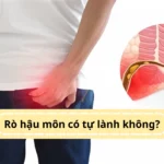 rò hậu môn có tự lành không