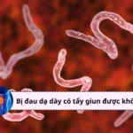 bị đau dạ dày có tẩy giun được không