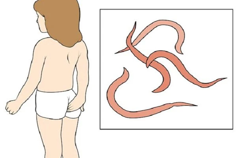 bị đau dạ dày có tẩy giun được không