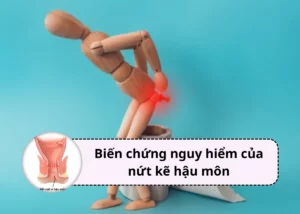 biến chứng của nứt kẽ hậu môn